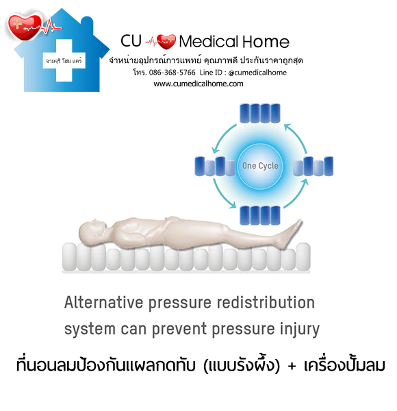 ที่นอนลม ป้องกันแผลกดทับ แบบรังผึ้ง